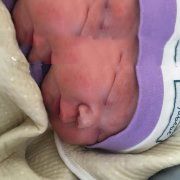 恭喜广州董先生在广州代妈机构的帮助下喜得贵子