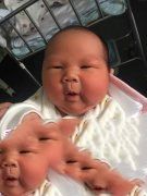 子宫内壁薄促排失败多次，终于在广州试管助孕专家的帮助下成功产子 