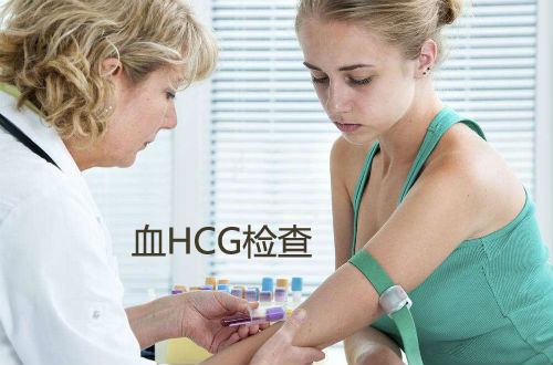 血HCG检查