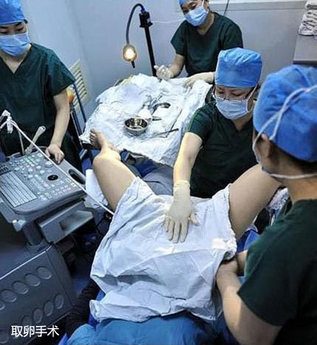 医生正在进行取卵手术